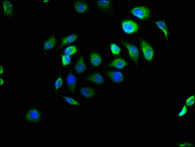 Immunofluorescence staining of A549 cells with EFHD1 Antibody at 1:166, counter-stained with DAPI. The cells were fixed in 4% formaldehyde, permeabilized using 0.2% Triton X-100 and blocked in 10% normal Goat Serum. The cells were then incubated with the antibody overnight at 4°C. The secondary antibody was Alexa Fluor 488-congugated AffiniPure Goat Anti-Rabbit IgG(H+L).Rabbit anti-Human EFHD1 Polyclonal Antibody