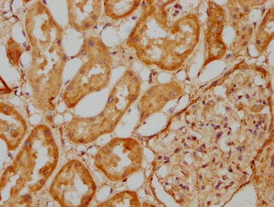 IHC image of EFHD1 Antibody diluted at 1:500 and staining in paraffin-embedded human kidney tissue performed on a Leica BondTM system. After dewaxing and hydration, antigen retrieval was mediated by high pressure in a citrate buffer (pH 6.0). Section was blocked with 10% normal goat serum 30min at RT. Then primary antibody (1% BSA) was incubated at 4°C overnight. The primary is detected by a biotinylated secondary antibody and visualized using an HRP conjugated SP system.Rabbit anti-Human EFHD1 Polyclonal Antibody