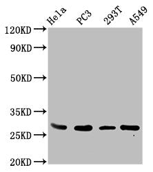 Western Blot | Positive WB detected in: Hela whole cell lysate, PC-3 whole cell lysate, 293T whole cell lysate, A549 whole cell lysate | All lanes: EFHD1 antibody at 3.4μg/ml | Secondary | Goat polyclonal to rabbit IgG at 1/50000 dilution | Predicted band size: 27, 17 kDa | Observed band size: 27 kDaRabbit anti-Human EFHD1 Polyclonal Antibody