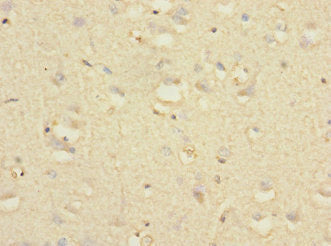 Immunohistochemistry of paraffin-embedded human brain tissue using NTM Antibody at dilution of 1:100Rabbit anti-Human NTM Polyclonal Antibody