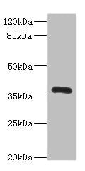 Western blot  | All lanes: NTM antibody IgG at 2.42μg/ml + Mouse liver tissue  | Secondary  | Goat polyclonal to rabbit IgG at 1/10000 dilution  | Predicted band size: 38, 35, 40 kDa  | Observed band size: 38 kDaRabbit anti-Human NTM Polyclonal Antibody