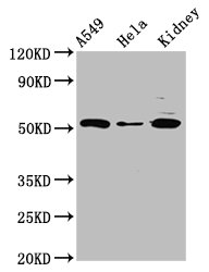 Western Blot  | Positive WB detected in: A549 whole cell lysate, Hela whole cell lysate, Rat kidney tissue  | All lanes: FICD antibody at 3µg/ml  | Secondary  | Goat polyclonal to rabbit IgG at 1/50000 dilution  | Predicted band size: 52 kDa  | Observed band size: 52 kDaRabbit anti-Human FICD Polyclonal Antibody