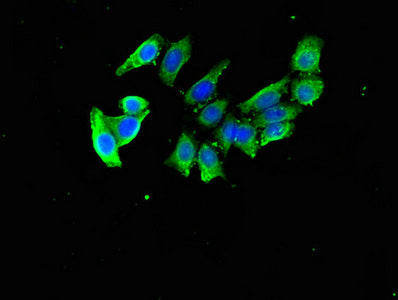 Immunofluorescent analysis of PC-3 cells using DDA1 Antibody at dilution of 1:100 and Alexa Fluor 488-congugated AffiniPure Goat Anti-Rabbit IgG(H+L)Rabbit anti-Human DDA1 Polyclonal Antibody