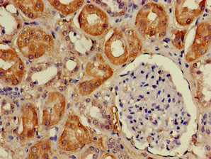 Immunohistochemistry of paraffin-embedded human kidney tissue using DDA1 Antibody at dilution of 1:100Rabbit anti-Human DDA1 Polyclonal Antibody