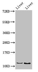 Western Blot  | Positive WB detected in: Rat liver tissue, Mouse liver tissue  | All lanes: DDA1 antibody at 2.8μg/ml  | Secondary  | Goat polyclonal to rabbit IgG at 1/50000 dilution  | Predicted band size: 12 kDa  | Observed band size: 12 kDaRabbit anti-Human DDA1 Polyclonal Antibody