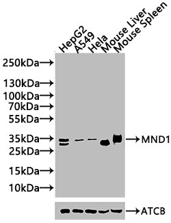 Western blot | All lanes: MND1 antibody at 10μg/ml + Jurkat whole cell lysate | Secondary | Goat polyclonal to rabbit IgG at 1/10000 dilution | Predicted band size: 24 kDa | Observed band size: 24 kDa