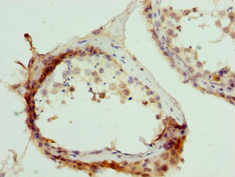 Immunohistochemistry of paraffin-embedded human testis tissue using TRIM55 Antibody at dilution of 1:100Rabbit anti-Human TRIM55 Polyclonal Antibody