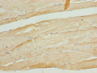 Immunohistochemistry of paraffin-embedded human skeletal muscle tissue using TRIM55 Antibody at dilution of 1:100Rabbit anti-Human TRIM55 Polyclonal Antibody