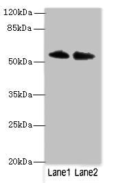 Western blot | All lanes: TRIM55 antibody at 1μg/ml | Lane 1: Hela whole cell lysate | Lane 2: Mouse liver tissue | Secondary | Goat polyclonal to rabbit IgG at 1/10000 dilution | Predicted band size: 61, 51, 27 kDa | Observed band size: 61 kDaRabbit anti-Human TRIM55 Polyclonal Antibody
