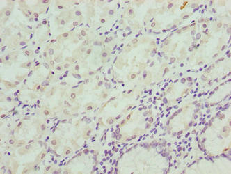 Immunohistochemistry of paraffin-embedded human stomach tissue using CIPC Antibody at dilution of 1:100Rabbit anti-Human CIPC Polyclonal Antibody
