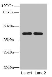 Western blot | All lanes: CIPC antibody at 6μg/ml | Lane 1: A431 whole cell lysate | Lane 2: NIH/3T3 whole cell lysate | Secondary | Goat polyclonal to rabbit IgG at 1/10000 dilution | Predicted band size: 43 kDa | Observed band size: 43 kDaRabbit anti-Human CIPC Polyclonal Antibody