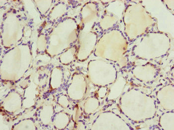 Immunohistochemistry of paraffin-embedded human thyroid tissue using CEP44 Antibody at dilution of 1:100Rabbit anti-Human CEP44 Polyclonal Antibody