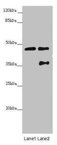 Western blot | All lanes: CEP44 antibody at 3.09 μg/ml | Lane 1: Jurkat whole cell lysate | Lane 2: MCF-7 whole cell lysate | Secondary | Goat polyclonal to rabbit IgG at 1/10000 dilution | Predicted band size: 44 kDa | Observed band size: 44, 36 kDaRabbit anti-Human CEP44 Polyclonal Antibody