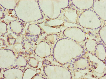 Immunohistochemistry of paraffin-embedded human thyroid tissue using CEP44 Antibody at dilution of 1:100Rabbit anti-Human CEP44 Polyclonal Antibody