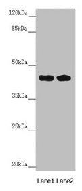 Western blot  | All lanes: CEP44 antibody at 6.92µg/ml  | Lane 1: Jurkat whole cell lysate  | Lane 2: MCF-7 whole cell lysate  | Secondary  | Goat polyclonal to rabbit IgG at 1/10000 dilution  | Predicted band size: 44 kDa  | Observed band size: 44 kDaRabbit anti-Human CEP44 Polyclonal Antibody