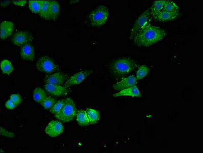 Immunofluorescent analysis of HepG2 cells using ELOVL4 Antibody at dilution of 1:100 and Alexa Fluor 488-congugated AffiniPure Goat Anti-Rabbit IgG(H+L)Rabbit anti-Human ELOVL4 Polyclonal Antibody