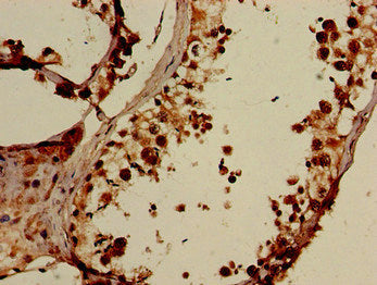 Immunohistochemistry of paraffin-embedded human testis tissue using the antibody at dilution of 1:100Rabbit anti-Human ELOVL4 Polyclonal Antibody