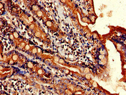 Immunohistochemistry of paraffin-embedded human small intestine tissue using ELOVL4 Antibody at dilution of 1:100Rabbit anti-Human ELOVL4 Polyclonal Antibody