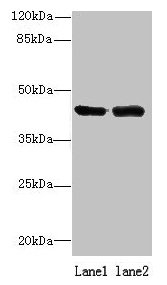 Western blot | All lanes: NIF3L1 antibody at 0.2μg/ml | Lane 1: 293T whole cell lysate | Lane 2: MDA-MB-231 whole cell lysate | Secondary | Goat polyclonal to rabbit IgG at 1/10000 dilution | Predicted band size: 42, 39, 33 kDa | Observed band size: 42 kDaRabbit anti-Human NIF3L1 Polyclonal Antibody