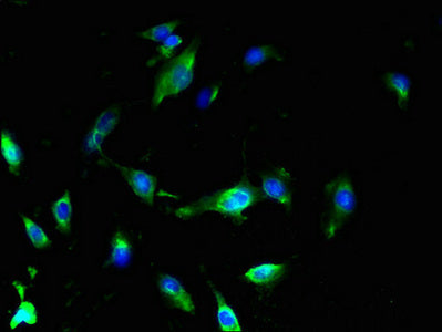 Immunofluorescent analysis of U251 cells using SLC25A18 Antibody at dilution of 1:100 and Alexa Fluor 488-congugated AffiniPure Goat Anti-Rabbit IgG(H+L)Rabbit anti-Human SLC25A18 Polyclonal Antibody