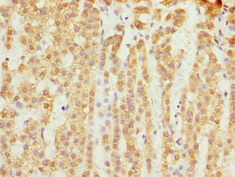 Immunohistochemistry of paraffin-embedded human adrenal gland tissue using SLC25A18 Antibody at dilution of 1:100Rabbit anti-Human SLC25A18 Polyclonal Antibody