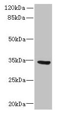 Western blot | All lanes: SLC25A18 antibody at 0.3μg/ml + U87 whole cell lysate | Secondary | Goat polyclonal to rabbit IgG at 1/10000 dilution | Predicted band size: 34 kDa | Observed band size: 34 kDaRabbit anti-Human SLC25A18 Polyclonal Antibody