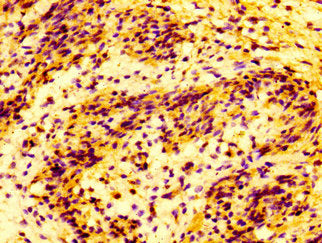 IHC image of MMP28 Antibody diluted at 1:100 and staining in paraffin-embedded human lung tissue performed on a Leica BondTM system. After dewaxing and hydration, antigen retrieval was mediated by high pressure in a citrate buffer (pH 6.0). Section was blocked with 10% normal goat serum 30min at RT. Then primary antibody (1% BSA) was incubated at 4°C overnight. The primary is detected by a biotinylated secondary antibody and visualized using an HRP conjugated SP system.Rabbit anti-Human MMP28 Polyclonal Antibody