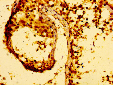 IHC image of MMP28 Antibody diluted at 1:100 and staining in paraffin-embedded human testis tissue performed on a Leica BondTM system. After dewaxing and hydration, antigen retrieval was mediated by high pressure in a citrate buffer (pH 6.0). Section was blocked with 10% normal goat serum 30min at RT. Then primary antibody (1% BSA) was incubated at 4°C overnight. The primary is detected by a biotinylated secondary antibody and visualized using an HRP conjugated SP system.Rabbit anti-Human MMP28 Polyclonal Antibody