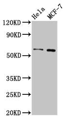 Western Blot  | Positive WB detected in: Hela whole cell lysate, MCF-7 whole cell lysate  | All lanes: MMP28 antibody at 3.2µg/ml  | Secondary  | Goat polyclonal to rabbit IgG at 1/50000 dilution  | Predicted band size: 59, 15 kDa  | Observed band size: 59 kDa