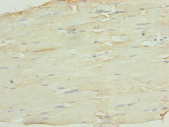 Immunohistochemistry of paraffin-embedded human skeletal muscle tissue using SH3BGRL3 Antibody at dilution of 1:100Rabbit anti-Human SH3BGRL3 Polyclonal Antibody
