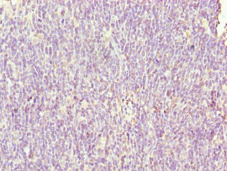 Immunohistochemistry of paraffin-embedded human thymus tissue using SH3BGRL3 Antibody at dilution of 1:100Rabbit anti-Human SH3BGRL3 Polyclonal Antibody
