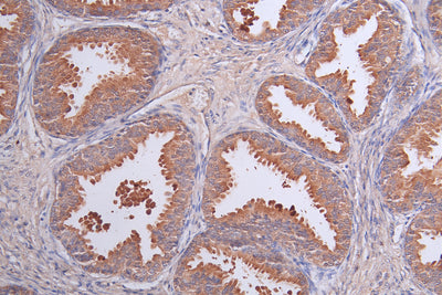 Immunohistochemistry of paraffin-embedded human prostate tissue using LRRN3 Antibody at dilution of 1:50