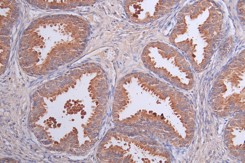 Immunohistochemistry of paraffin-embedded human prostate tissue using LRRN3 Antibody at dilution of 1:50