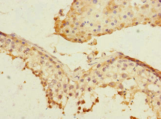 Immunohistochemistry of paraffin-embedded human testis tissue using PLK3 Antibody at dilution of 1:100Rabbit anti-Human PLK3 Polyclonal Antibody
