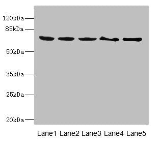 Western blot | All lanes: PLK3 antibody at 1.2μg/ml | Lane 1: Rat heart tissue | Lane 2: Hela whole cell lysate | Lane 3: 293T whole cell lysate | Lane 4: MCF-7 whole cell lysate | Lane 5: Monocytic leukemia cells in mice Macrophages | Secondary | Goat polyclonal to rabbit IgG at 1/10000 dilution | Predicted band size: 72 kDa | Observed band size: 72 kDaRabbit anti-Human PLK3 Polyclonal Antibody