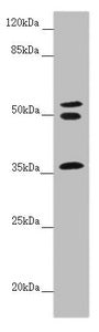 Western blot | All lanes: RNF41 antibody at 5.55 μg/ml + Mouse brain tissue | Secondary | Goat polyclonal to rabbit IgG at 1/10000 dilution | Predicted band size: 36, 28 kDa | Observed band size: 36, 50, 55 kDaRabbit anti-Human RNF41 Polyclonal Antibody