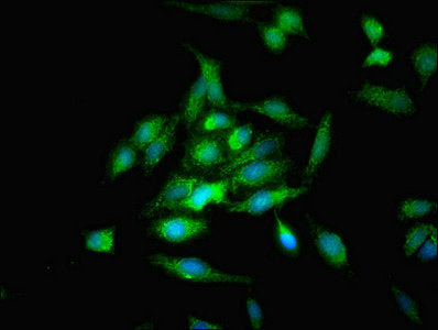 Immunofluorescent analysis of Hela cells using OPA3 Antibody at dilution of 1:100 and Alexa Fluor 488-congugated AffiniPure Goat Anti-Rabbit IgG(H+L)Rabbit anti-Human OPA3 Polyclonal Antibody