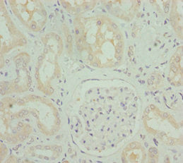 Immunohistochemistry of paraffin-embedded human kidney tissue using OPA3 Antibody at dilution of 1:100Rabbit anti-Human OPA3 Polyclonal Antibody