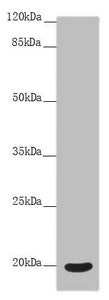 Western blot | All lanes: OPA3 antibody at 4.91 μg/ml + Mouse eye tissue | Secondary | Goat polyclonal to rabbit IgG at 1/10000 dilution | Predicted band size: 20, 21 kDa | Observed band size: 20 kDaRabbit anti-Human OPA3 Polyclonal Antibody