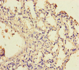 Immunohistochemistry of paraffin-embedded human lung tissue using WDR54 Antibody at dilution of 1:100Rabbit anti-Human WDR54 Polyclonal Antibody