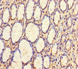 Immunohistochemistry of paraffin-embedded human stomach tissue using WDR54 Antibody at dilution of 1:100Rabbit anti-Human WDR54 Polyclonal Antibody