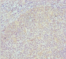 Immunohistochemistry of paraffin-embedded human tonsil tissue using COG4 Antibody at dilution of 1:100Rabbit anti-Human COG4 Polyclonal Antibody