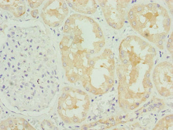 Immunohistochemistry of paraffin-embedded human kidney tissue using COG4 Antibody at dilution of 1:100Rabbit anti-Human COG4 Polyclonal Antibody