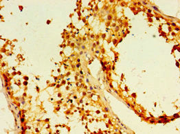 Immunohistochemistry of paraffin-embedded human testis tissue using EDA2R Antibody at dilution of 1:100Rabbit anti-Human EDA2R Polyclonal Antibody