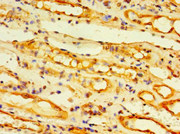Immunohistochemistry of paraffin-embedded human kidney tissue using EDA2R Antibody at dilution of 1:100Rabbit anti-Human EDA2R Polyclonal Antibody