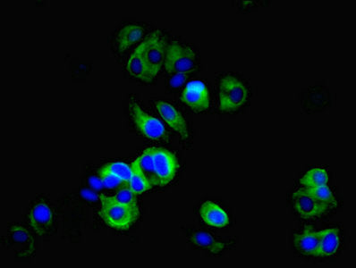 Immunofluorescent analysis of MCF-7 cells using TMEM27 Antibody at dilution of 1:100 and Alexa Fluor 488-congugated AffiniPure Goat Anti-Rabbit IgG(H+L)