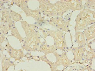 Immunohistochemistry of paraffin-embedded human kidney tissue using the antibody at dilution of 1:100