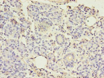 Immunohistochemistry of paraffin-embedded human pancreatic tissue using TMEM27 Antibody at dilution of 1:100