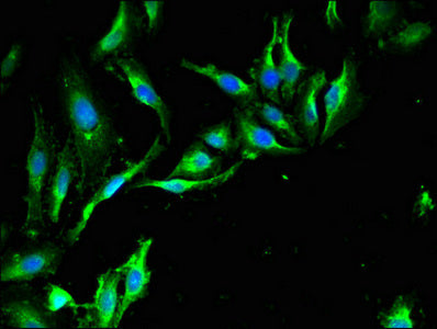 Immunofluorescent analysis of Hela cells using TRIM39 Antibody at dilution of 1:100 and Alexa Fluor 488-congugated AffiniPure Goat Anti-Rabbit IgG(H+L)Rabbit anti-Human TRIM39 Polyclonal Antibody