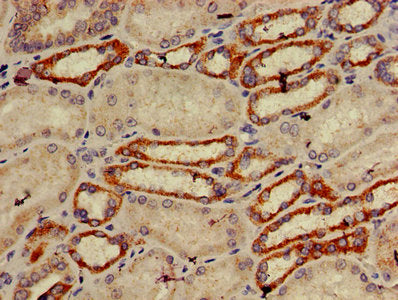IHC image of TRIM39 Antibody diluted at 1:600 and staining in paraffin-embedded human kidney tissue performed on a Leica BondTM system. After dewaxing and hydration, antigen retrieval was mediated by high pressure in a citrate buffer (pH 6.0). Section was blocked with 10% normal goat serum 30min at RT. Then primary antibody (1% BSA) was incubated at 4°C overnight. The primary is detected by a biotinylated secondary antibody and visualized using an HRP conjugated SP system.Rabbit anti-Human TRIM39 Polyclonal Antibody